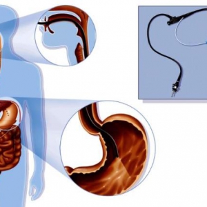 胃镜检查具有很重要的价值，运城众泰恳请大家不要轻易拒绝